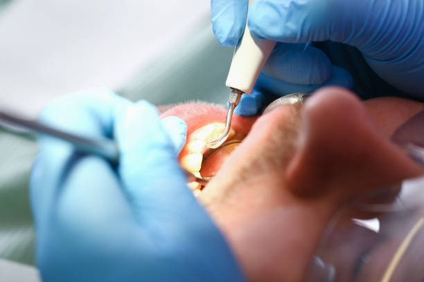 Best Emergency Dental Care for Broken or Chipped Teeth in Mianna, AR